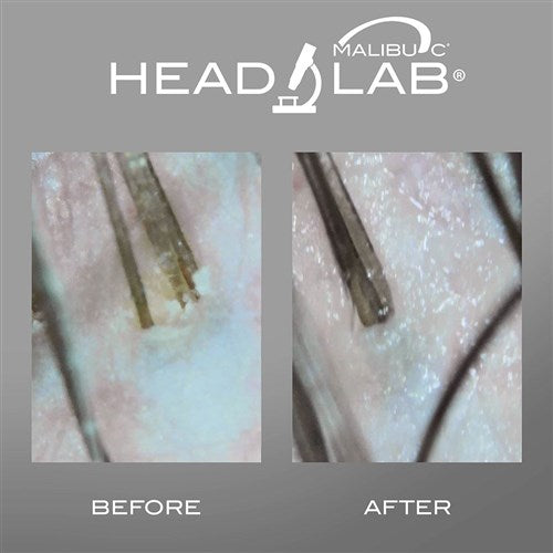 Malibu C Head lab before and after