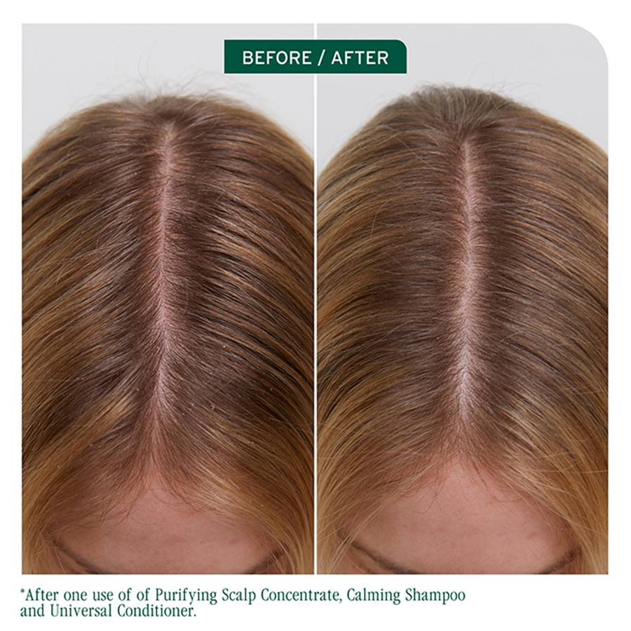 Biolage Scalp Sync Purifying Concentrate 200ml | Exfoliate & Removes Build Up