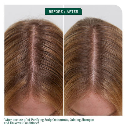 Biolage Scalp Sync Purifying Concentrate 200ml | Exfoliate & Removes Build Up