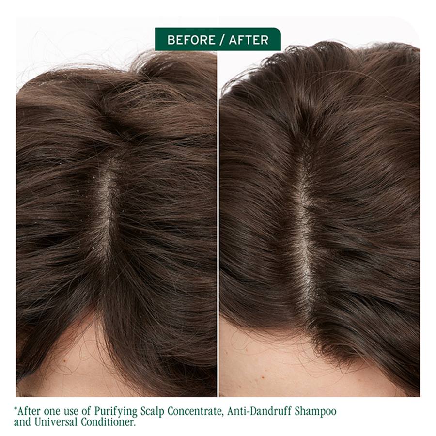 Biolage Scalp Sync Purifying Concentrate 200ml | Exfoliate & Removes Build Up