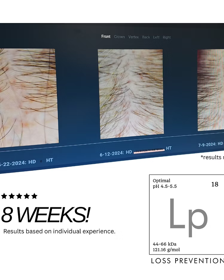 Hair Phix Scalp Phix 8-week clinical results showing improved scalp density and reduced thinning