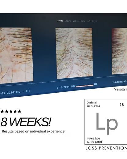 Hair Phix Scalp Phix 8-week clinical results showing improved scalp density and reduced thinning
