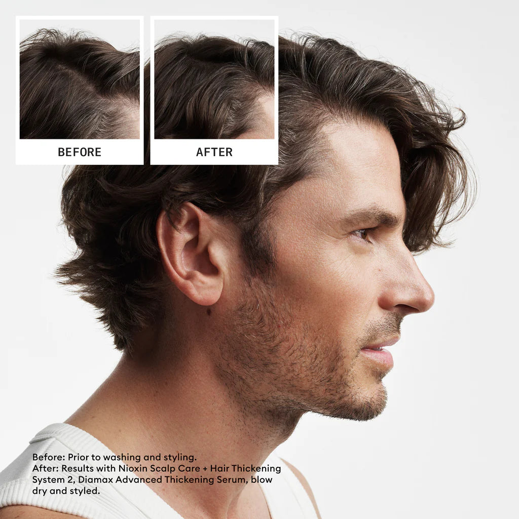 Nioxin System 2 300ml Duo - Natural Hair, Progressed Thinning
