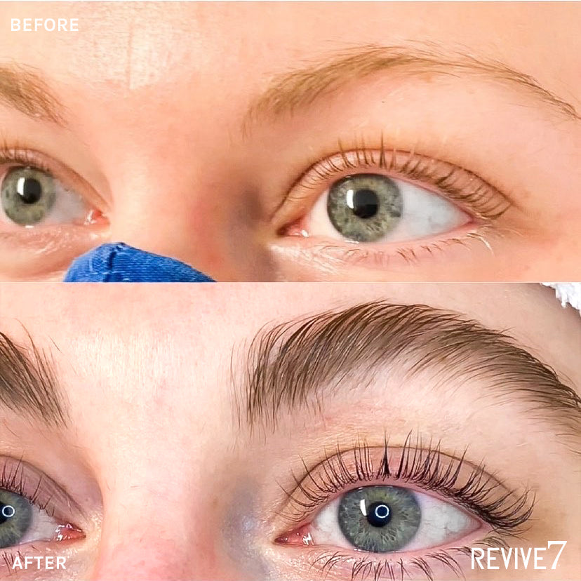 Revive7 Lash & Serum Before & After Canada